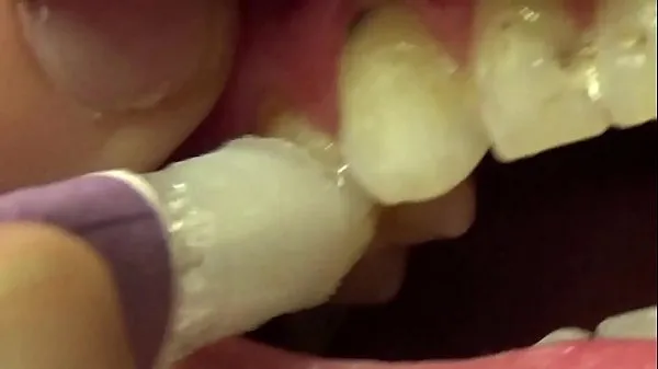 مقاطع فيديو عالية الدقة Applying Whitening Paste To Her Filthy Teeth